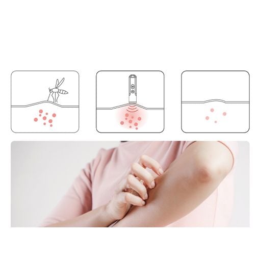 Εικόνα της Συσκευή Ανακούφισης Nitecore Bite Healer 10